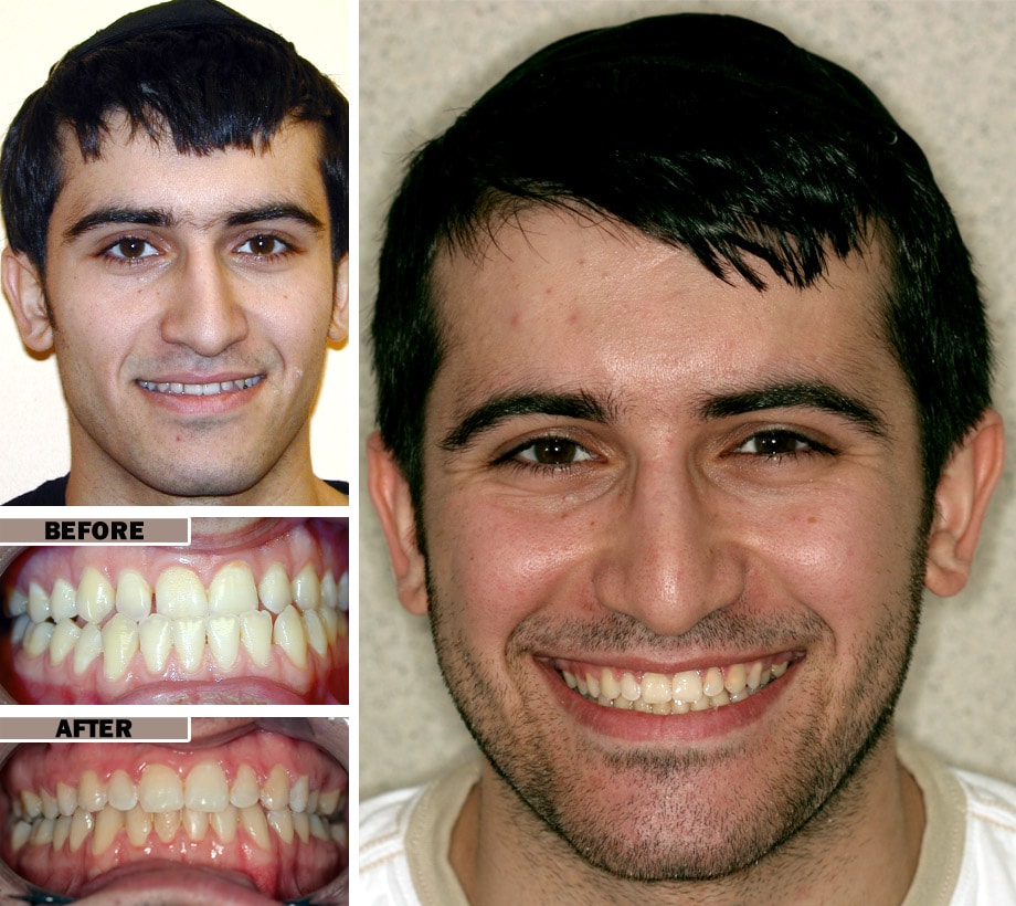 Alek ortho min Alek ortho min
