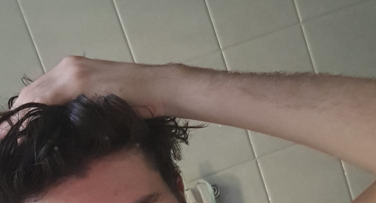 2643812 gamma hair