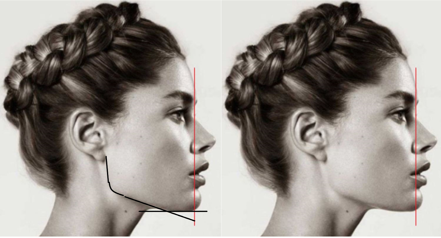 Doutzen profile dgsgsdfghdgsf