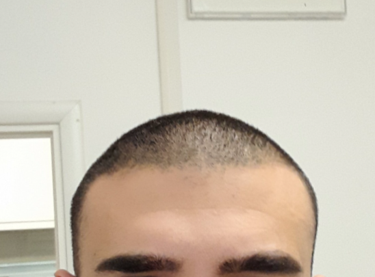 Before