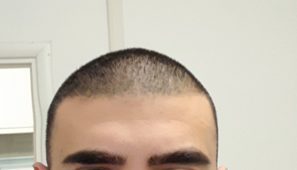 After