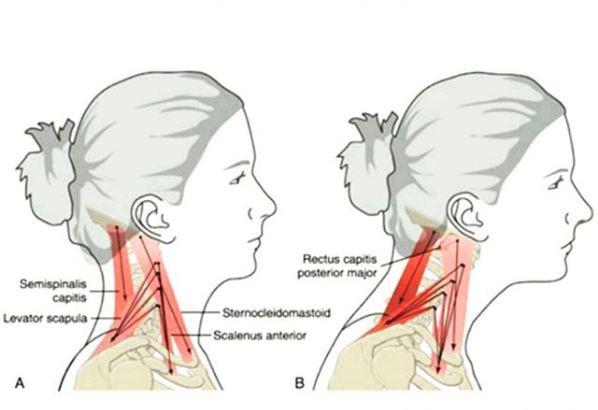 295FFE24 7584 4AAD 8FB6 D2935F4FC034