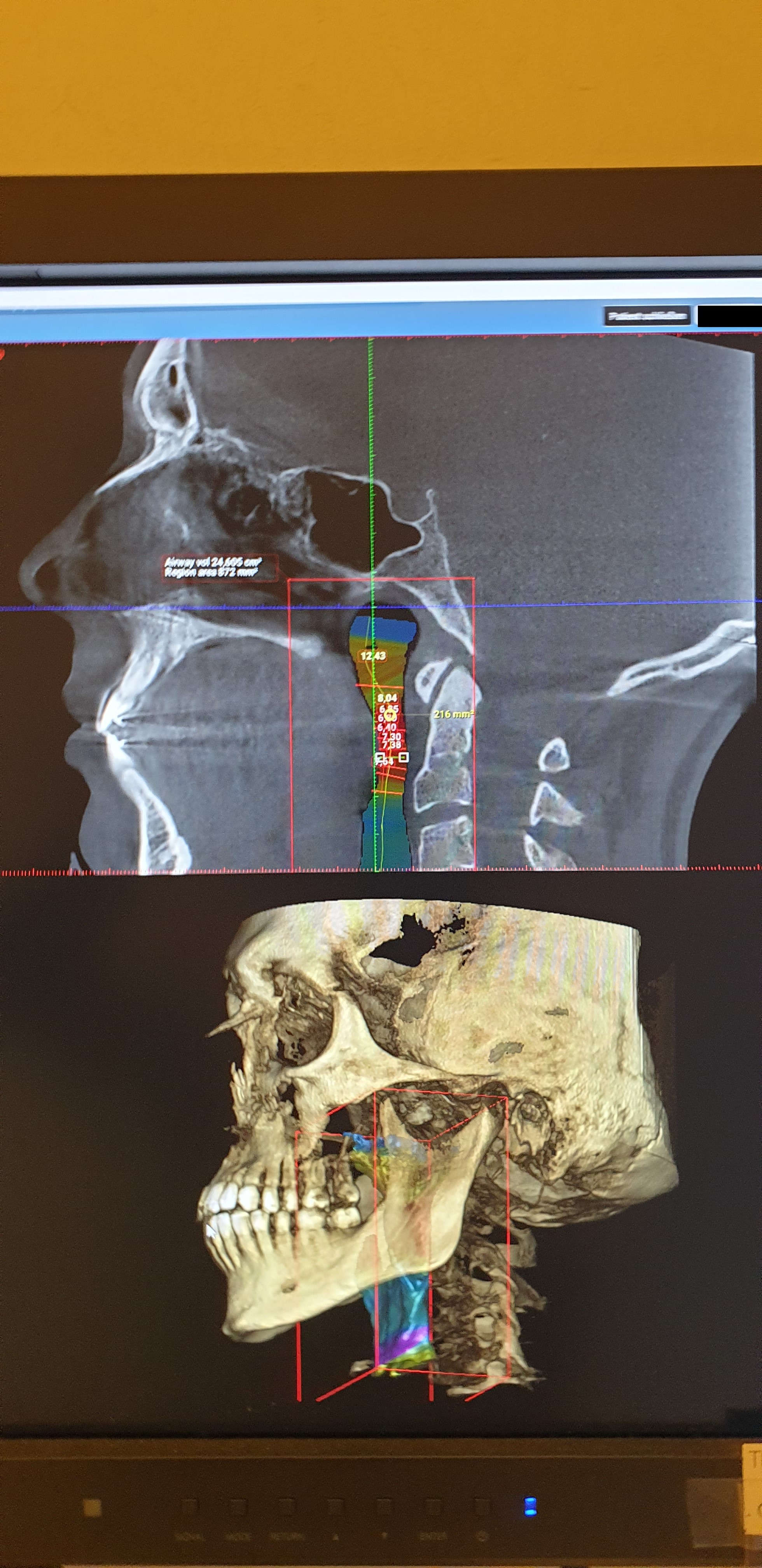 Ct scan anon   Copy