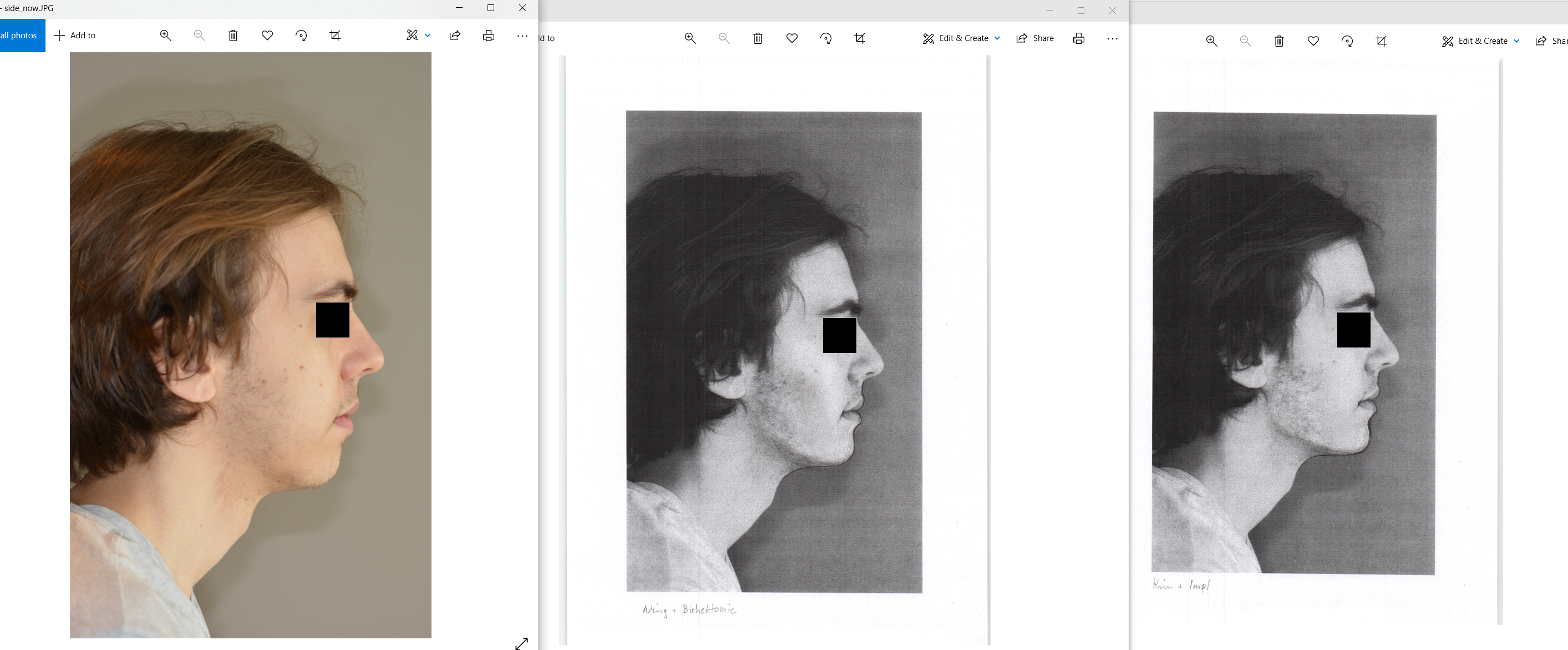 Sides comparison anon   Copy