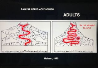 palatal suture morphology.png