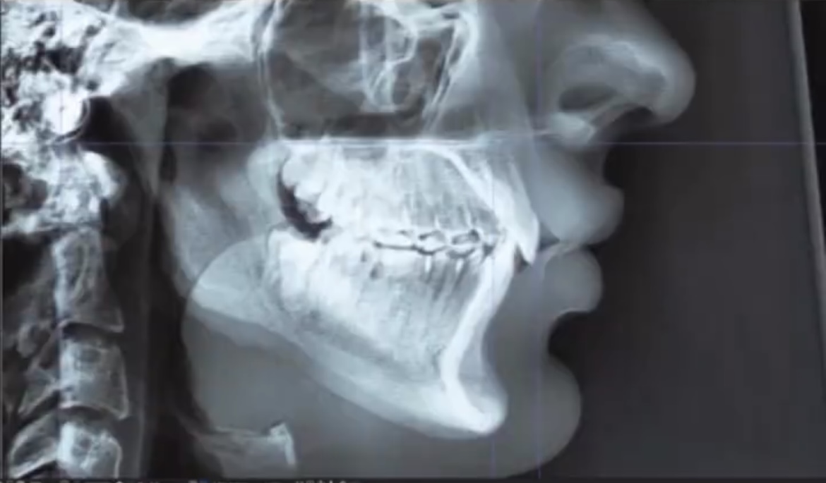 1D239D97 CB90 46D8 89D7 1BE2E398F7AD