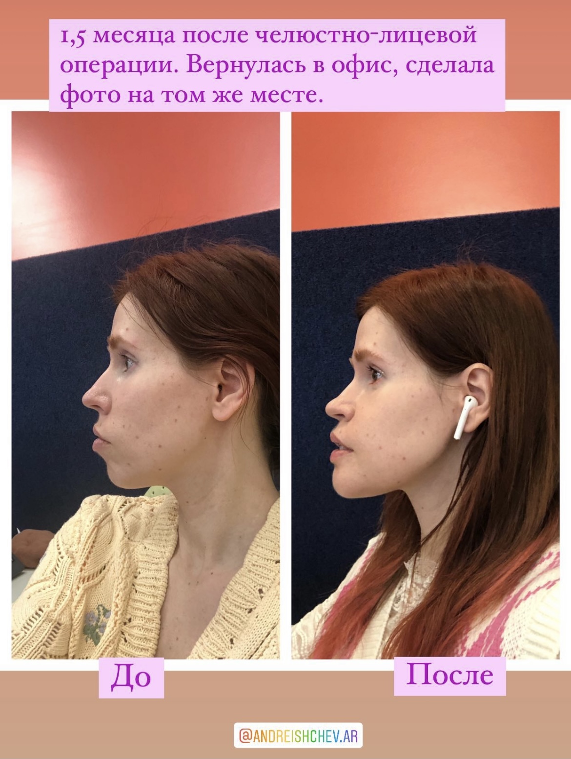 2663521 3DC64182 5563 43B2 A8D5 D81586D14984