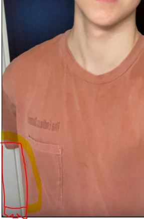 Arm