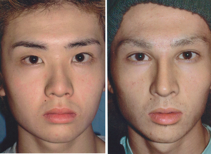 Extrememakeover