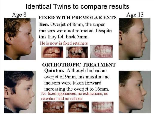 Ovjr00ah1fi21