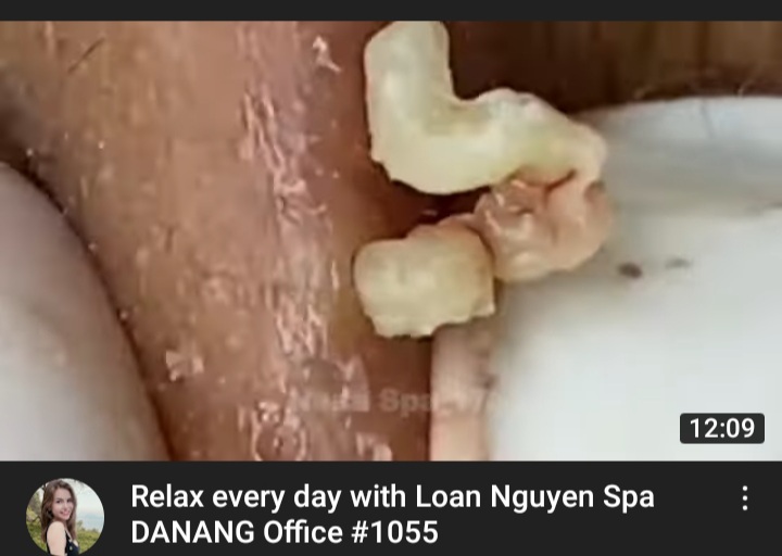 20220111 215635
