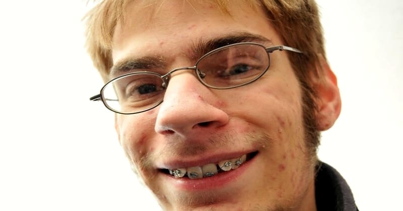 Ugly man