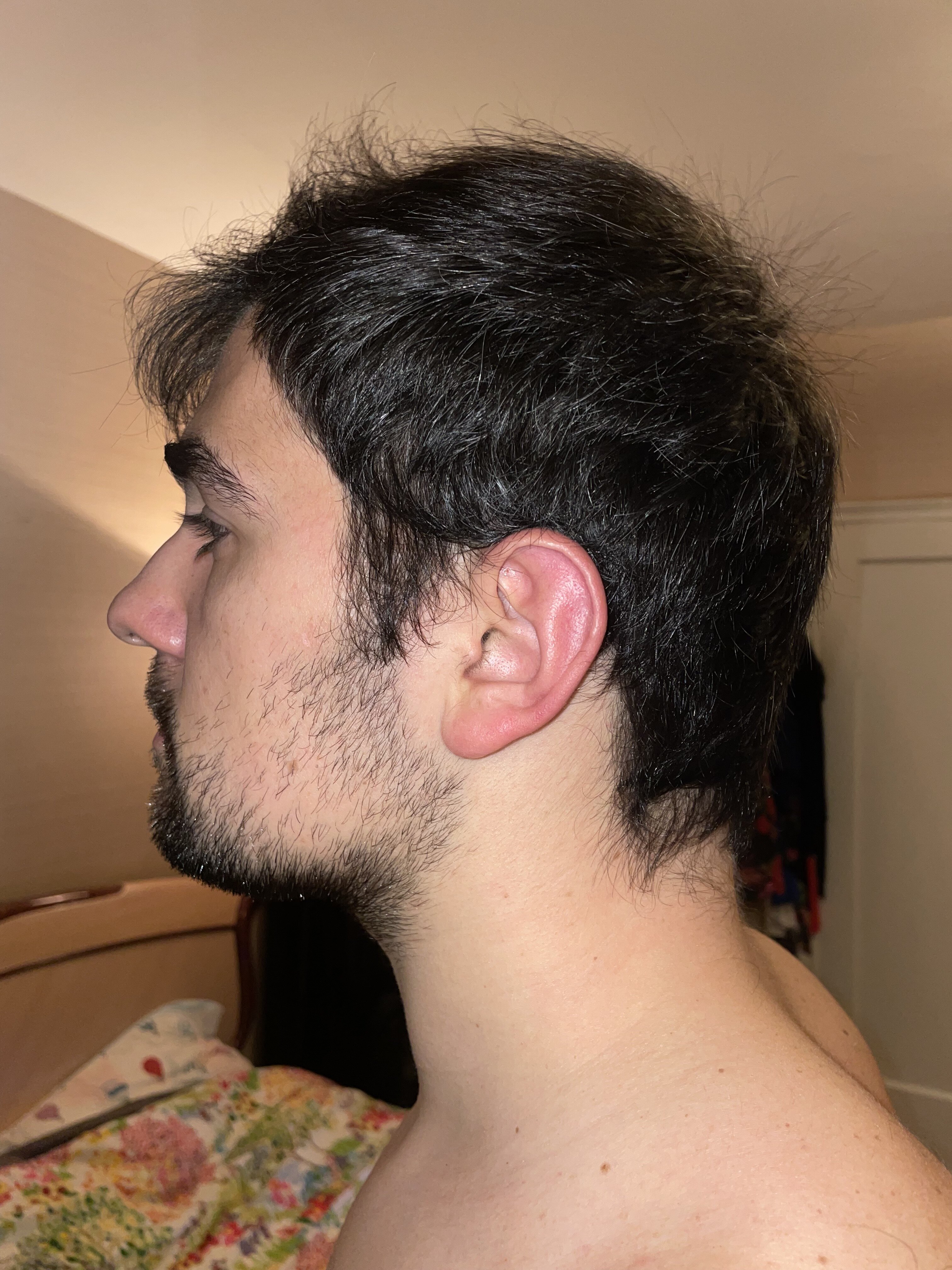 IMG 1418