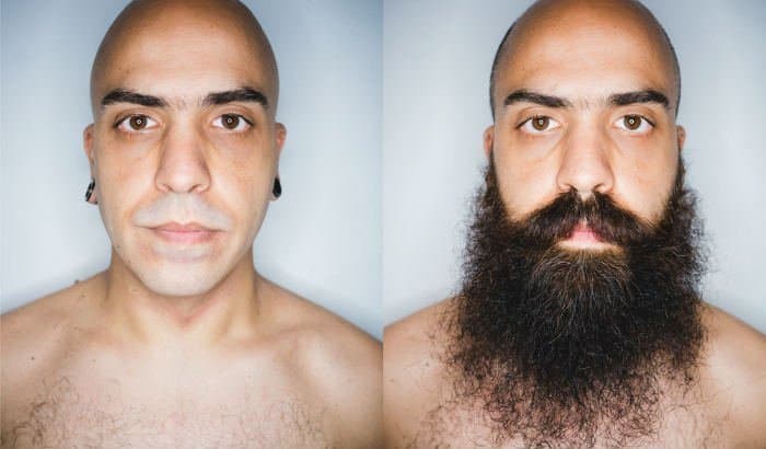 Before after beard