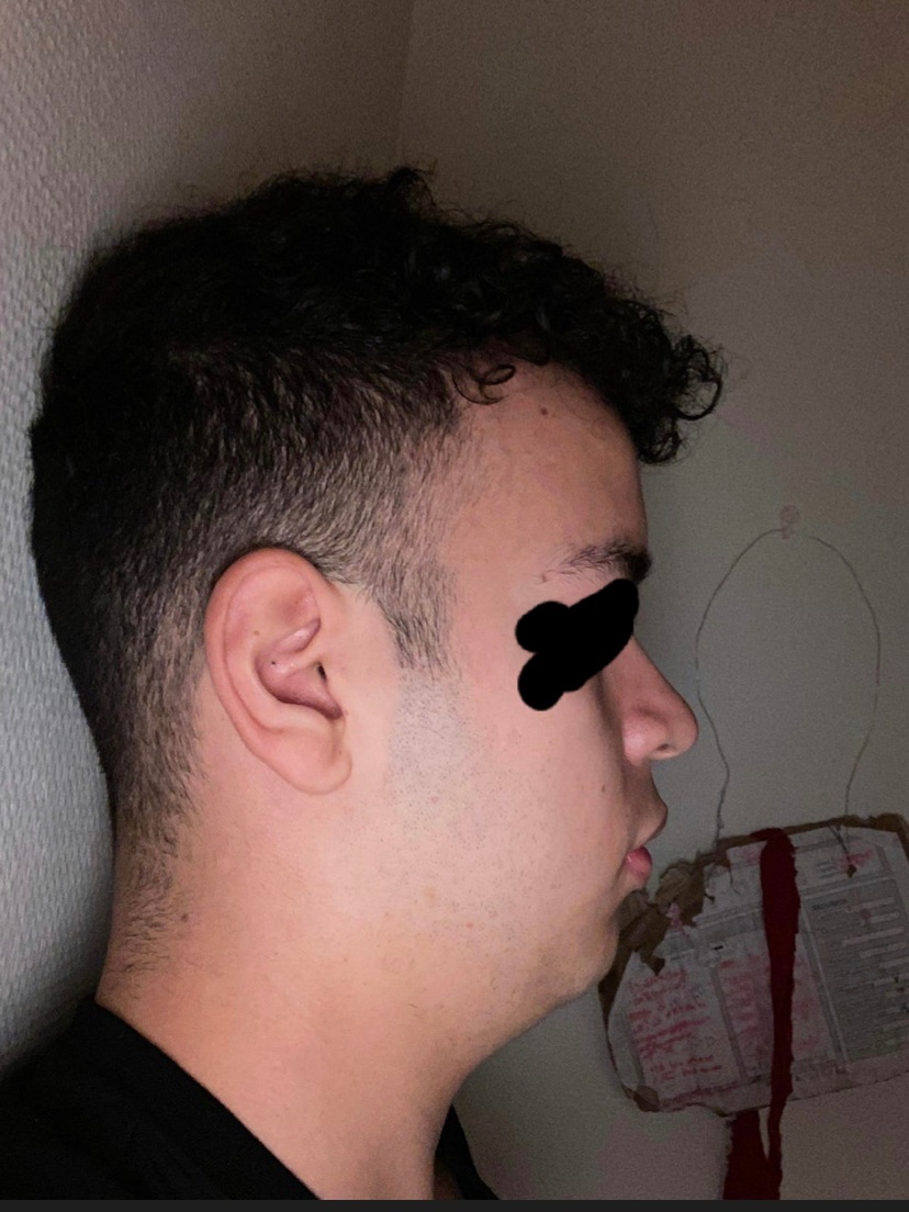 2618517 91D244E7 1FAA 44A7 8B4B 6E178CF0225F