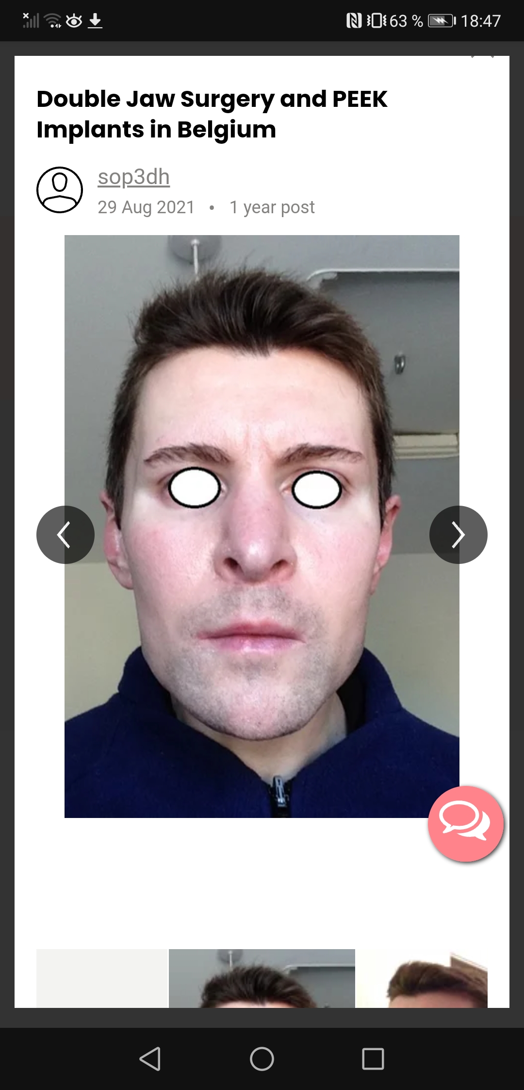 Screenshot 20220119 184723 comduckduckgomobileandroid