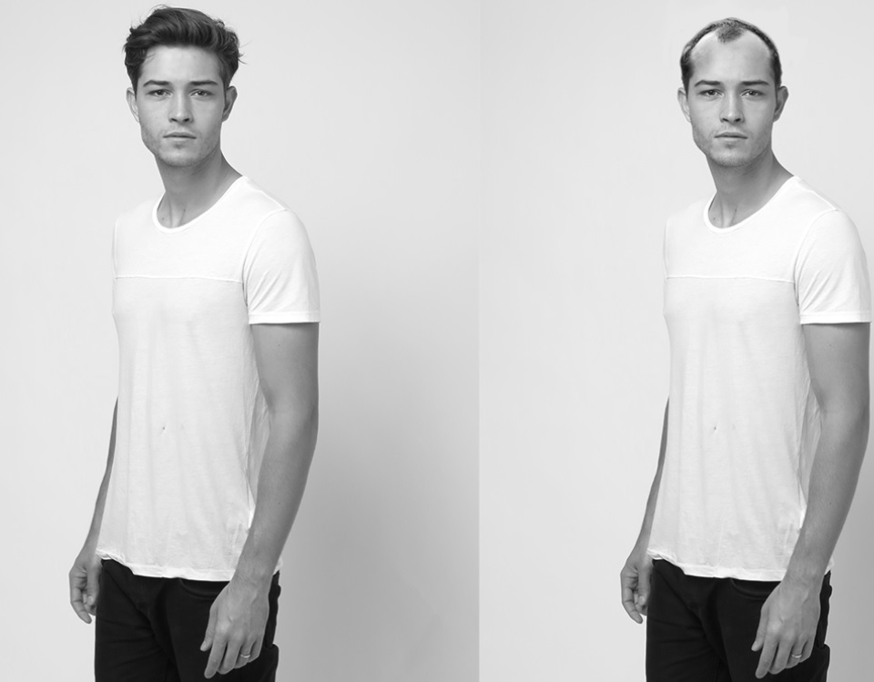 Hair