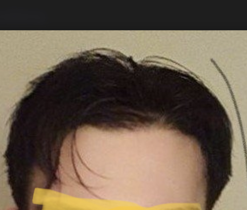 F587CEA7 F3B3 4D38 BE00 BE2A64F2C64B