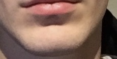 Chin