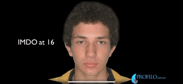 Insane imdo transformation