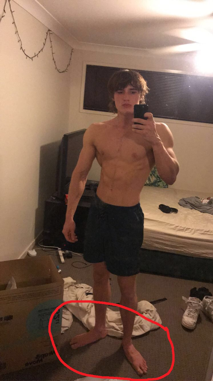 Feet