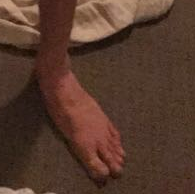 Feet1