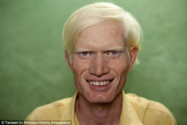 Chad