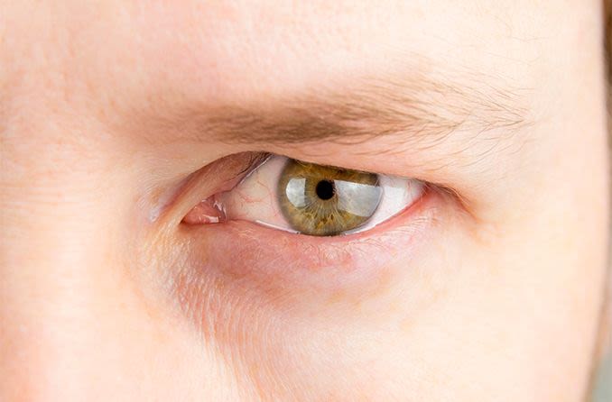 Hooded eyes hero compressor