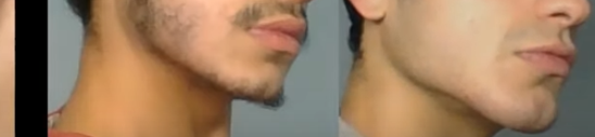 Bonesmash