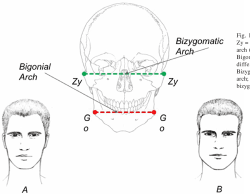 2 Figure1 1 1