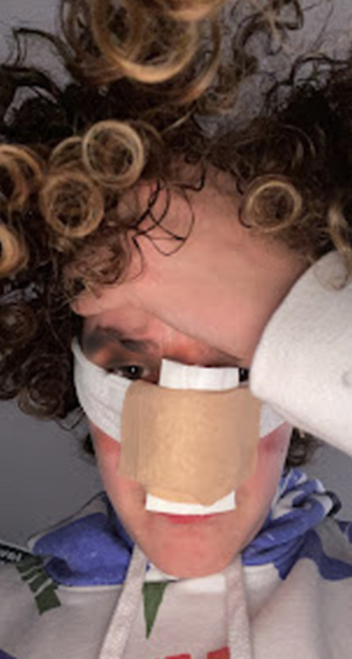 james nosejob 2.png