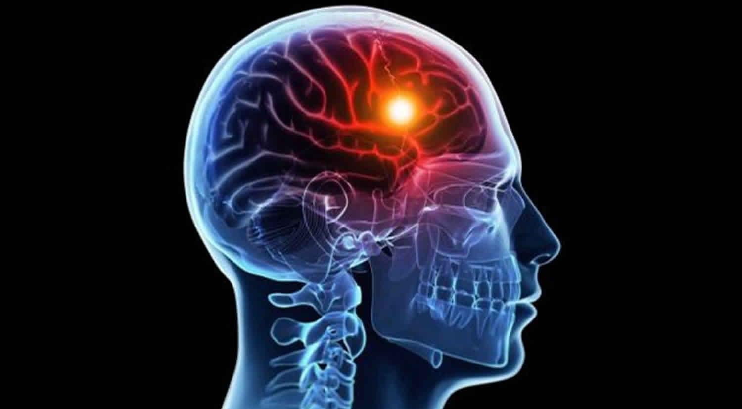 Cerebral hypoxia