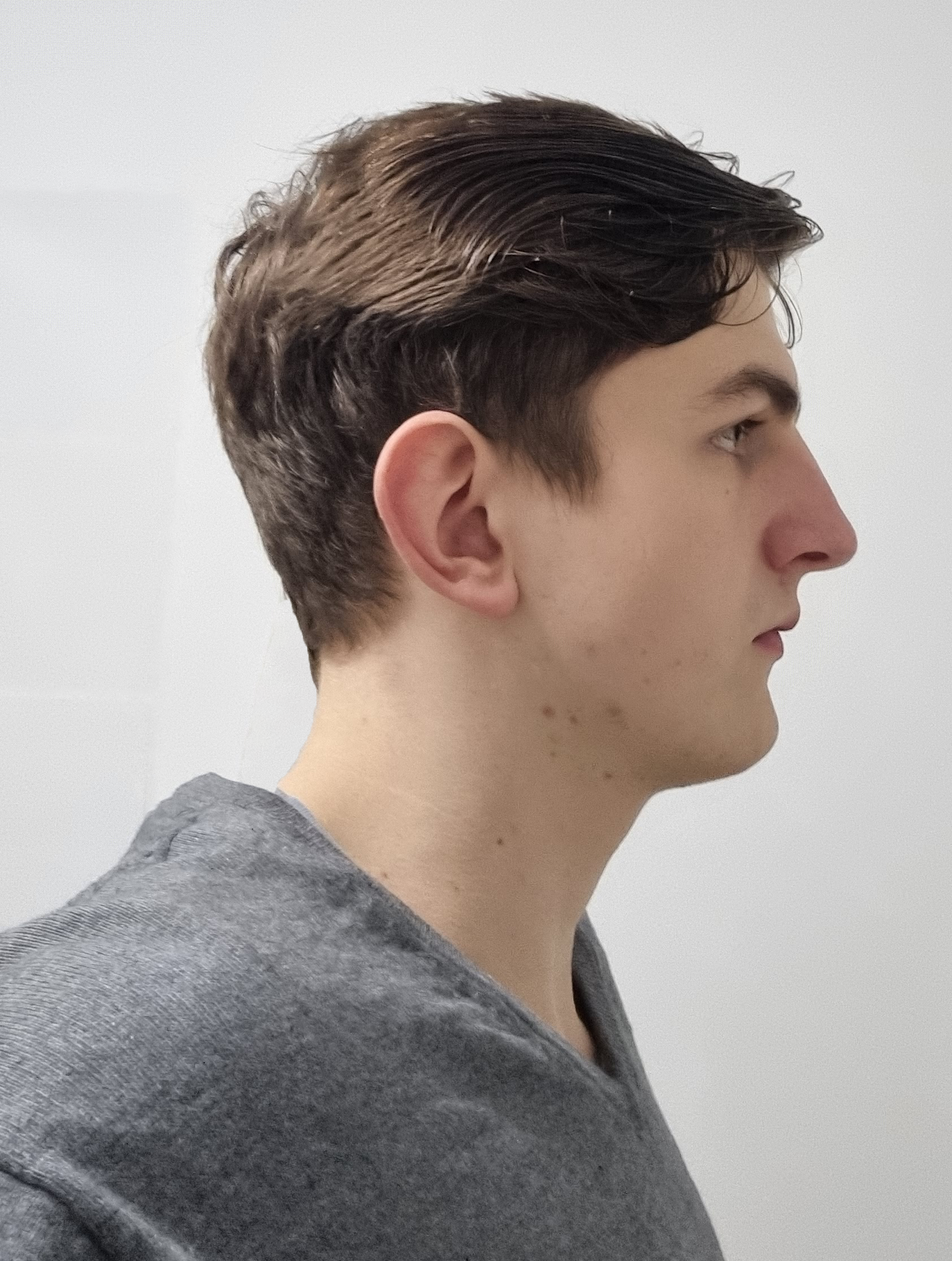 Mfw2