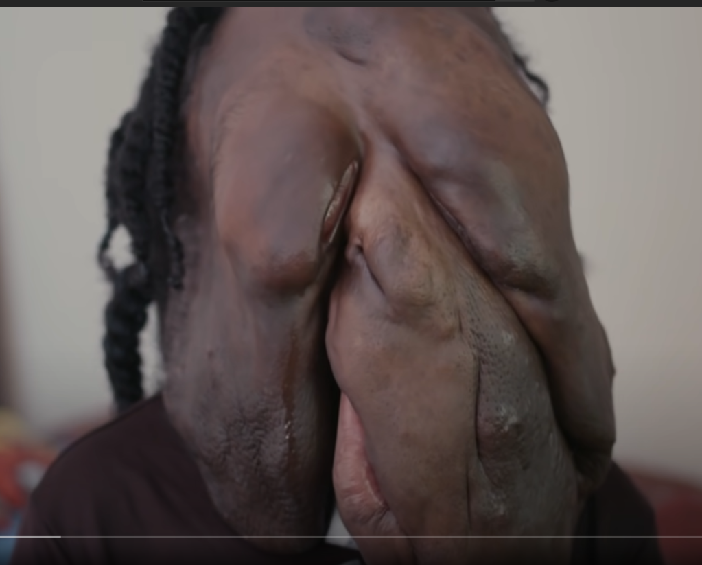 Fggh