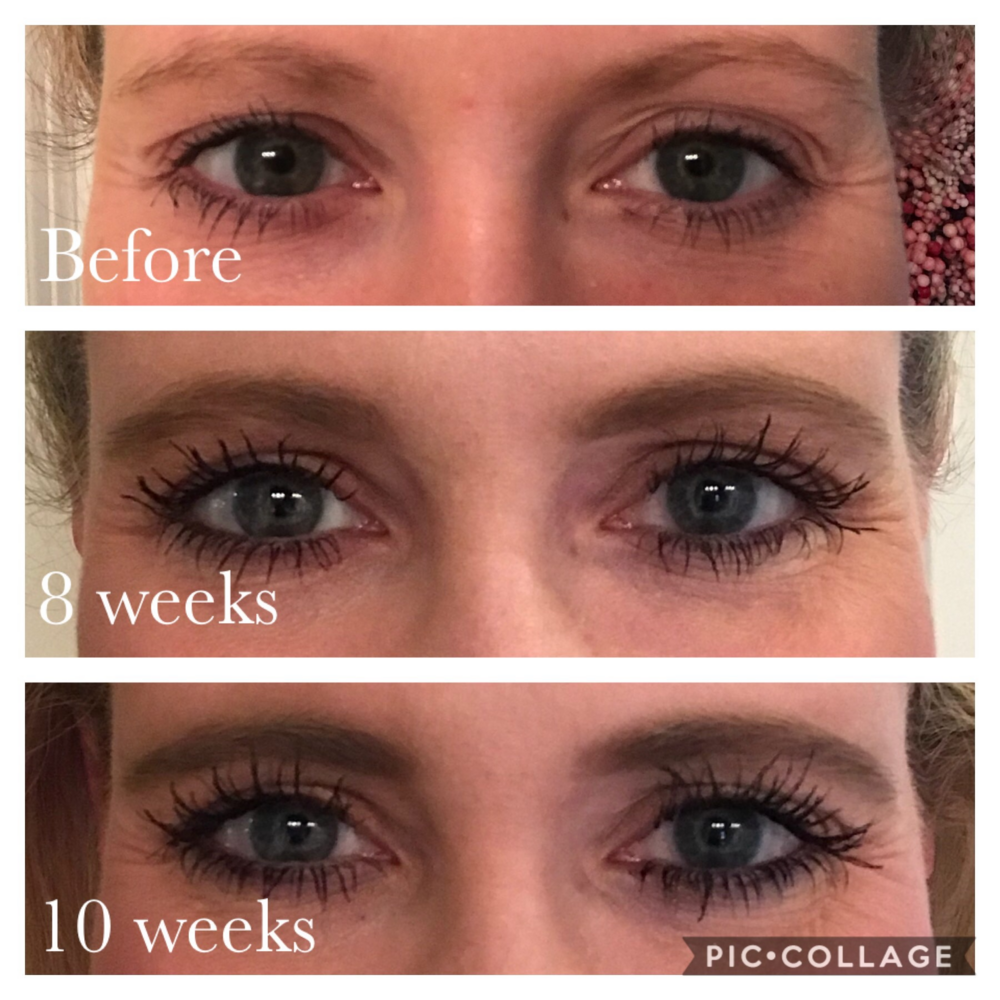 Insane latisse eyebrow transformation god tier 10 weeks isnane