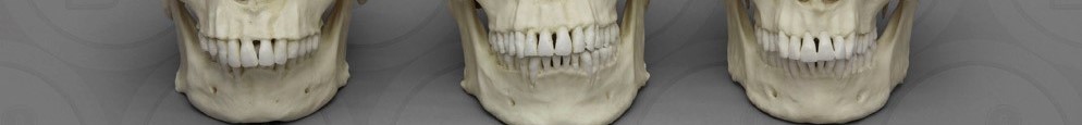 Mandible