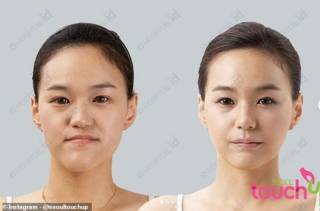 16439818 7275921 Bone shaving is used for a variety of medical treatments includi a 22 1564050