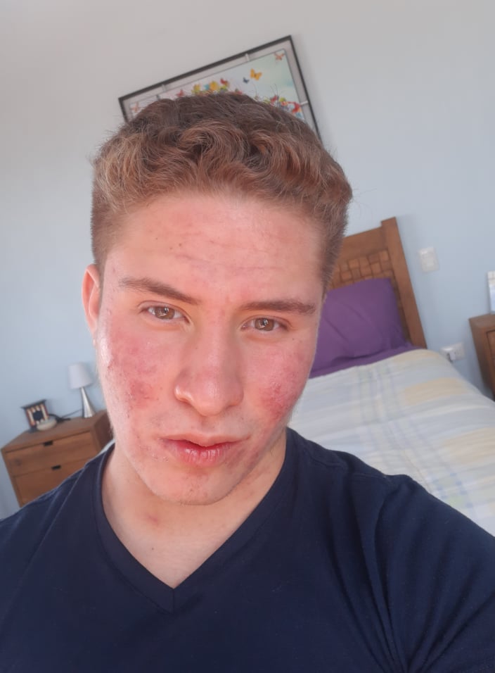 Hey
