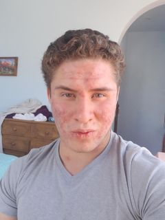 Face3