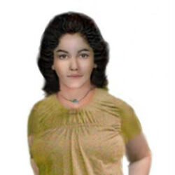 279ufmdReconstructionFullBody2