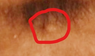 31