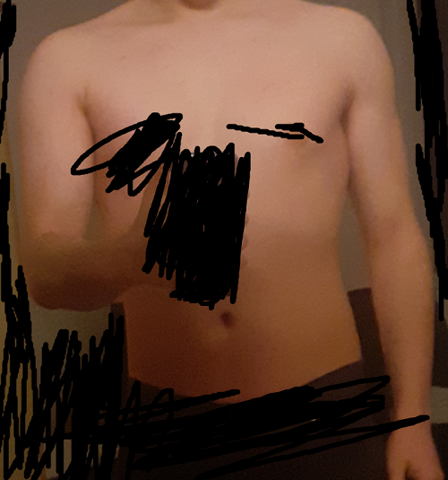 Retardo