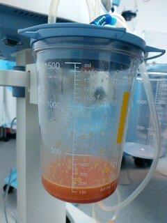 Fat Lipo