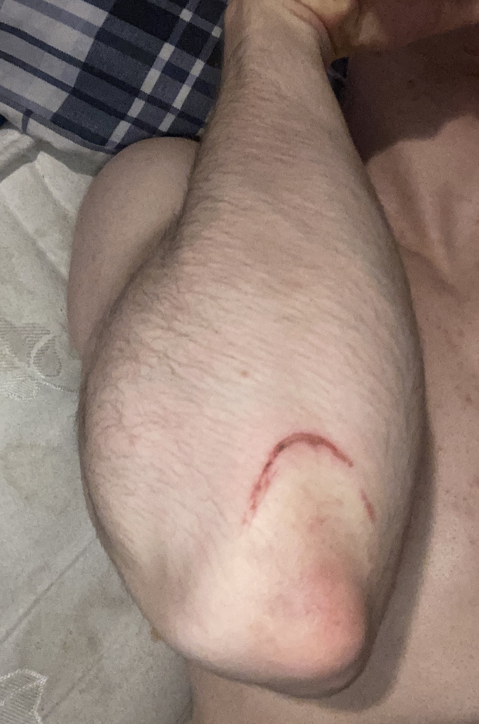 2D499B8A A1DF 4E17 A135 EEDDA6265093