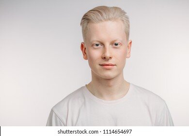 portrait-serious-blonde-albino-young-260nw-1114654697.jpg