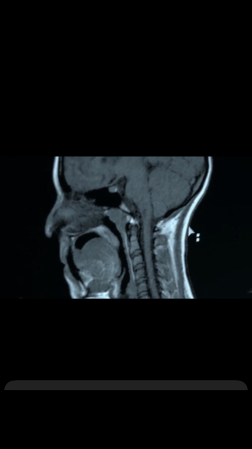 64528499-9BFC-43F8-8CC4-E8D8AC6810EB.png