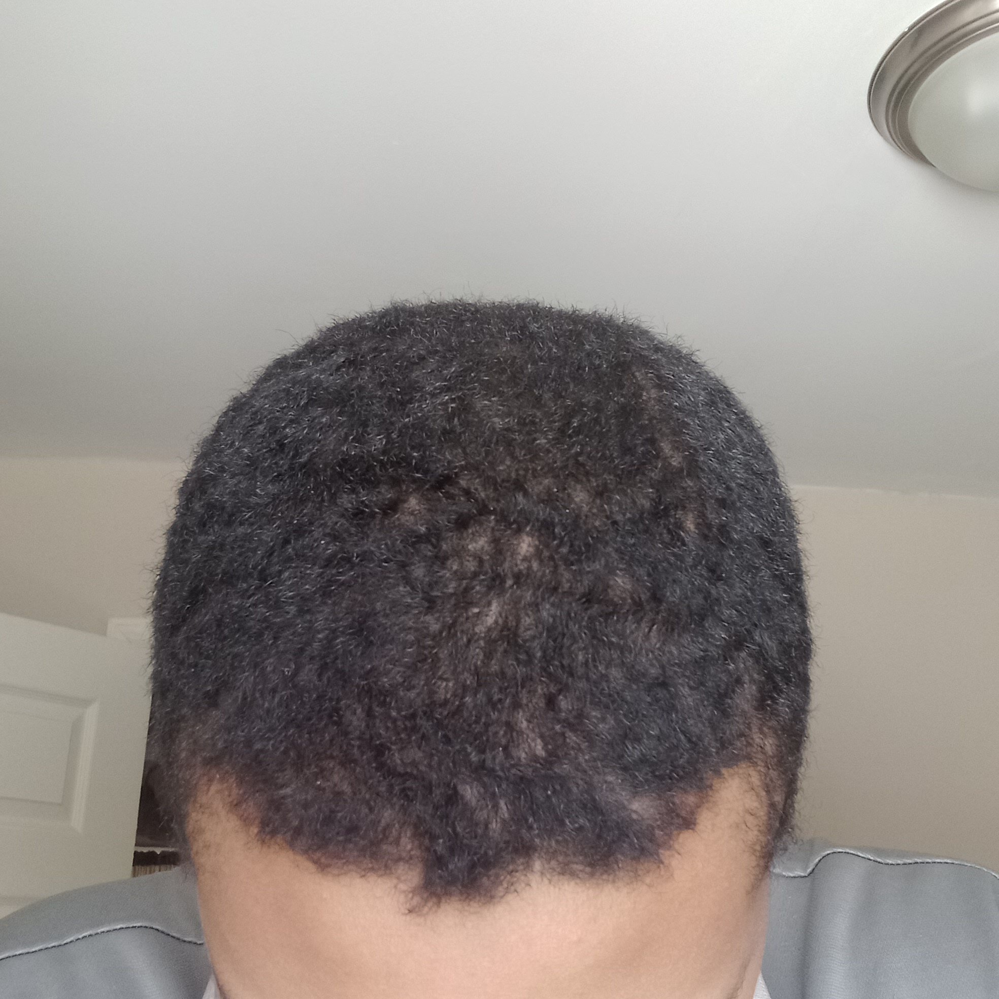 Hair 5