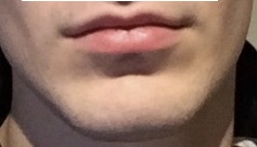 C1