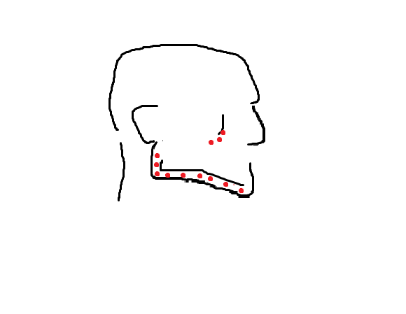 Bone projection