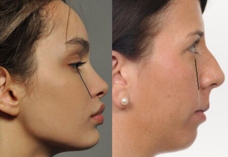 5F525840 3621 41AF A3C9 23DF4EF56364